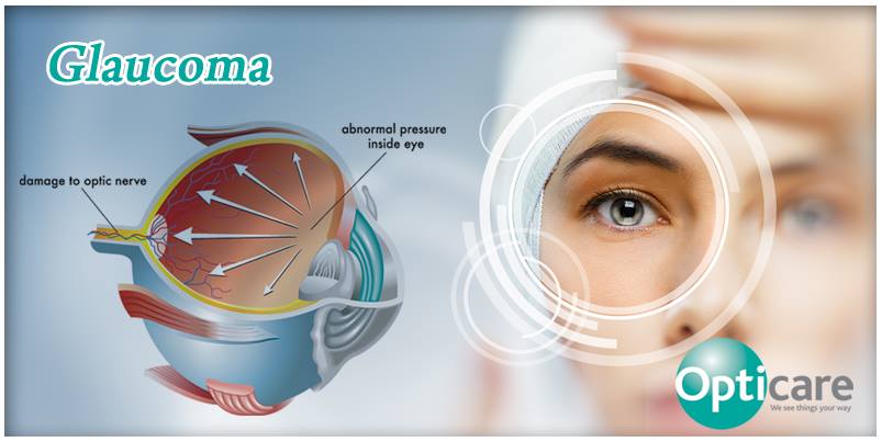 Glaucoma Screening by Opticare Optician